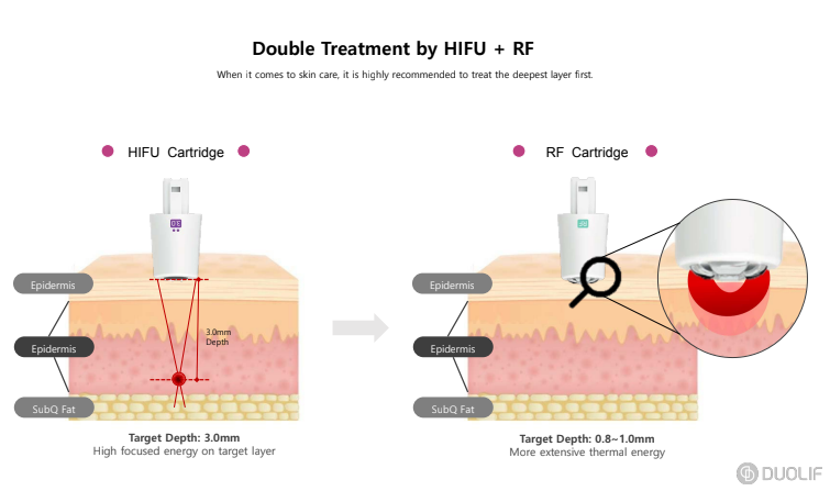 DUOLIF 2-in-1 HIFU (3mm) + RF gezichtslift apparaat